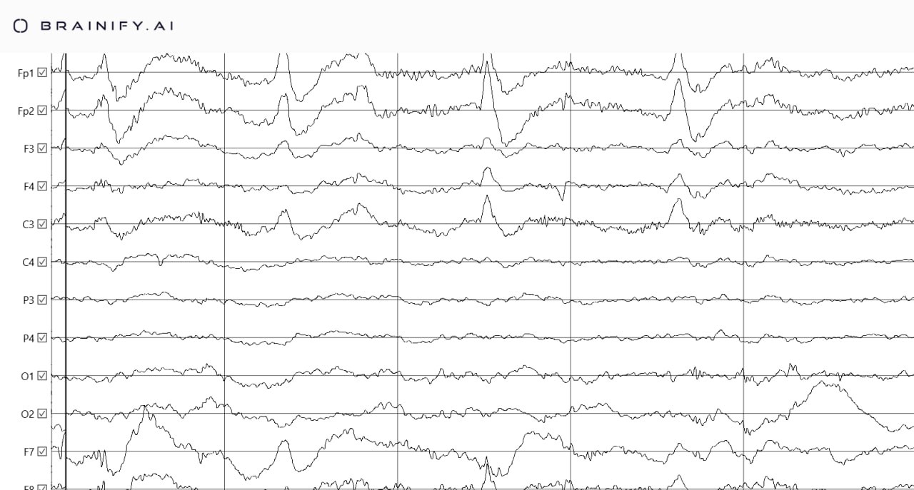 Brainify.ai — Платформа AI-диагностики мозга